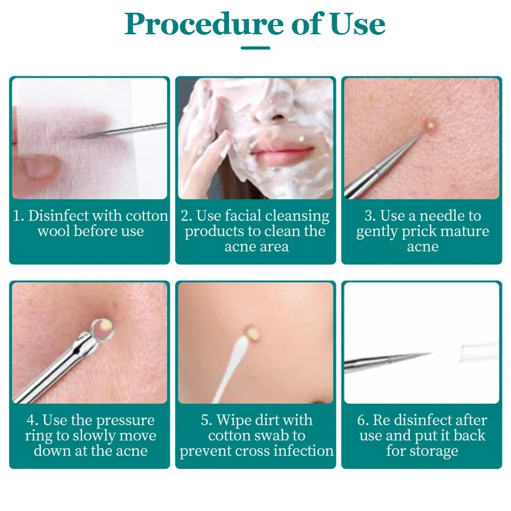 Blackhead Pimples Acne Needle